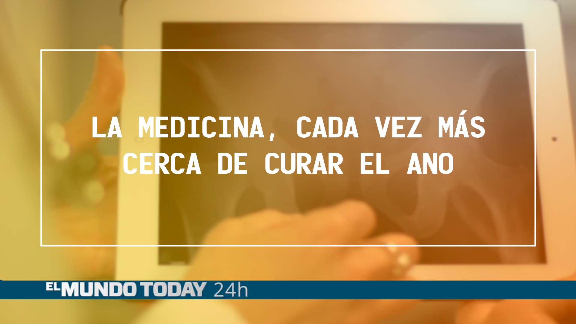 Temporada 1 La medicina está cada vez más cerca de curar el ano