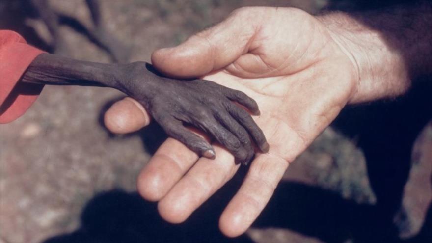 La mano del niño ugandés
