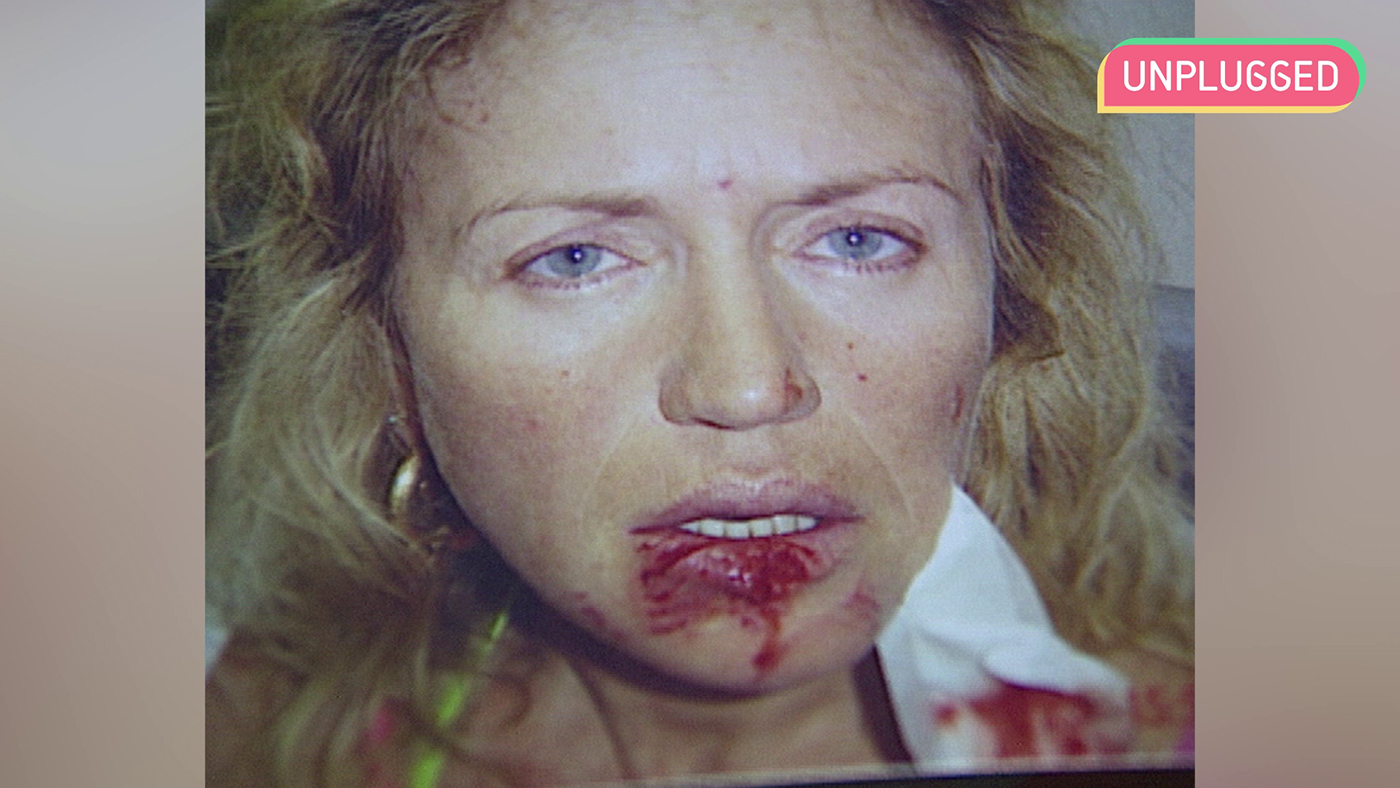 Temporada 1 Unplugged 12 - El accidente de Encarni Manfredi con el perro de Marta López