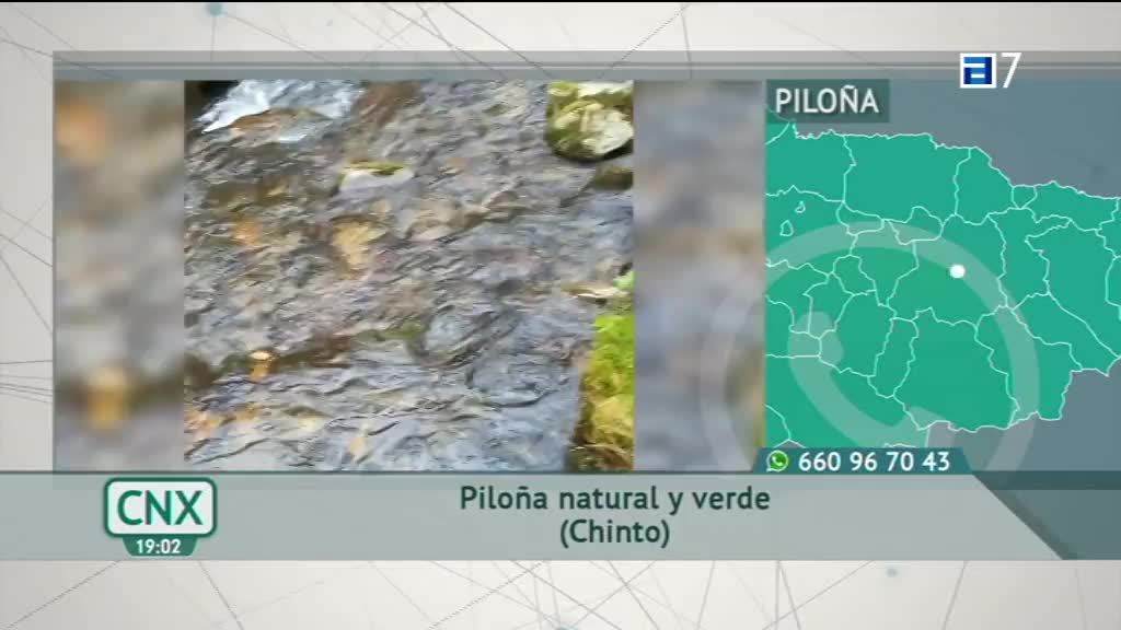 Las consecuencias del teletrabajo en nuestro cuerpo (Viernes, 19-02-2021)