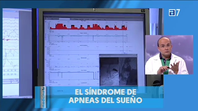 El síndrome de apneas del sueño (Martes, 17-06-2014)