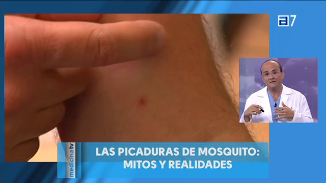 Las picaduras de mosquito (Martes, 08-07-2014)