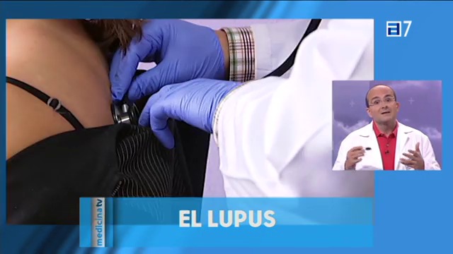 Lupus (Lunes, 26-05-2014)