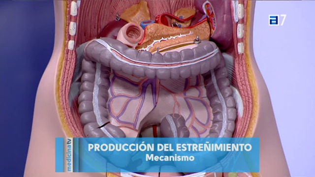 Prevenir el estreñimiento (Martes, 15-07-2014)