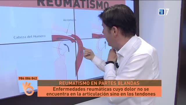 (Martes, 04-07-2017)