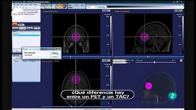 Técnicas de imagen