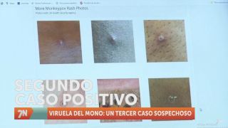 Jueves, 7 de julio II