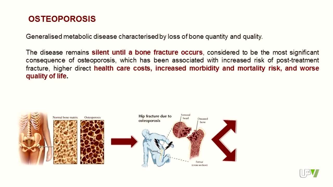 19-09-2014 Osteoporosis