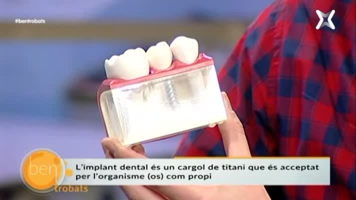 Implant dental
